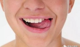 吃瓜吃的舌头疼缓解方法,吃瓜过度舌头疼的缓解攻略