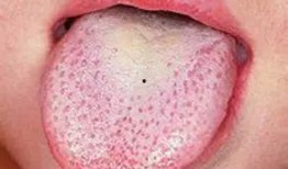 吃瓜舌头麻 原因,揭秘“吃瓜舌头麻”现象背后的科学原理