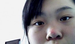 吃瓜嘴角发红,嘴角红润的秘密